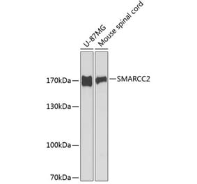 Western Blot - Anti-BAF170 Antibody (A11497) - Antibodies.com