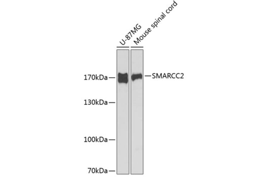 Western Blot - Anti-BAF170 Antibody (A11497) - Antibodies.com