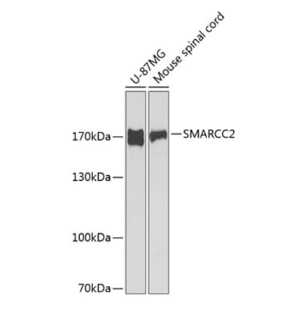 Western Blot - Anti-BAF170 Antibody (A11497) - Antibodies.com