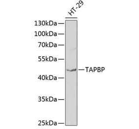 Western Blot - Anti-TPN Antibody (A11498) - Antibodies.com