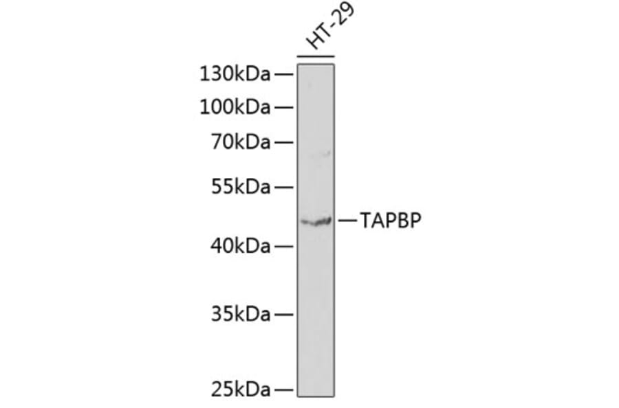 Western Blot - Anti-TPN Antibody (A11498) - Antibodies.com