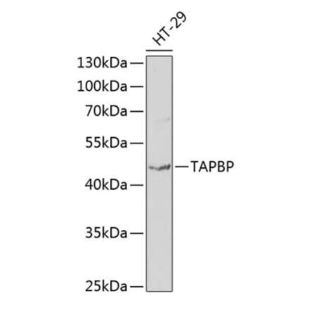Western Blot - Anti-TPN Antibody (A11498) - Antibodies.com