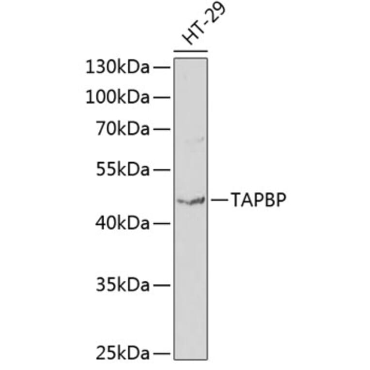 Western Blot - Anti-TPN Antibody (A11498) - Antibodies.com