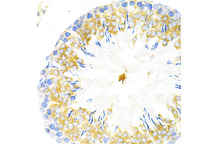 Immunohistochemistry - Anti-TPN Antibody (A11498) - Antibodies.com