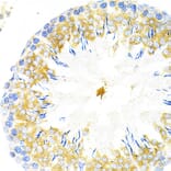 Immunohistochemistry - Anti-TPN Antibody (A11498) - Antibodies.com