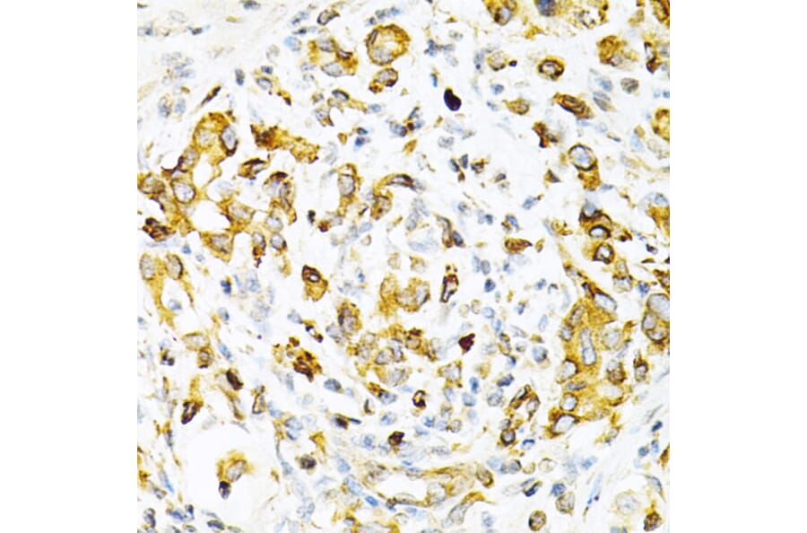 Immunohistochemistry - Anti-TPN Antibody (A11498) - Antibodies.com