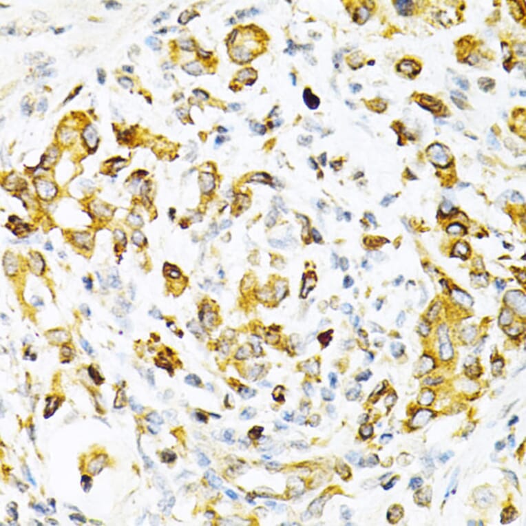 Immunohistochemistry - Anti-TPN Antibody (A11498) - Antibodies.com