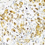 Immunohistochemistry - Anti-TPN Antibody (A11498) - Antibodies.com