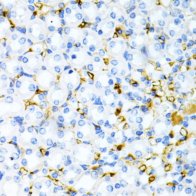 Immunohistochemistry - Anti-TPN Antibody (A11498) - Antibodies.com