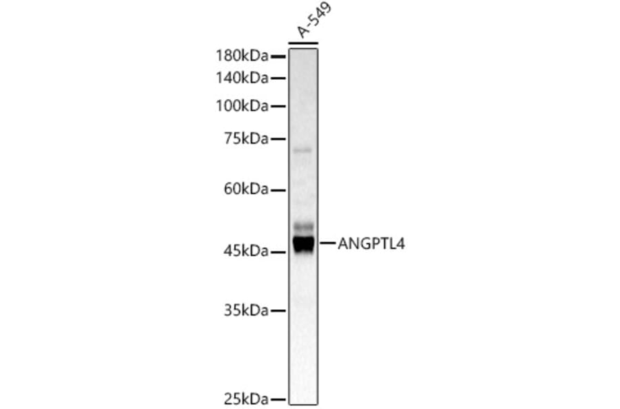 Western Blot - Anti-Angiopoietin-like 4/ANGPTL4 Antibody (A11502) - Antibodies.com