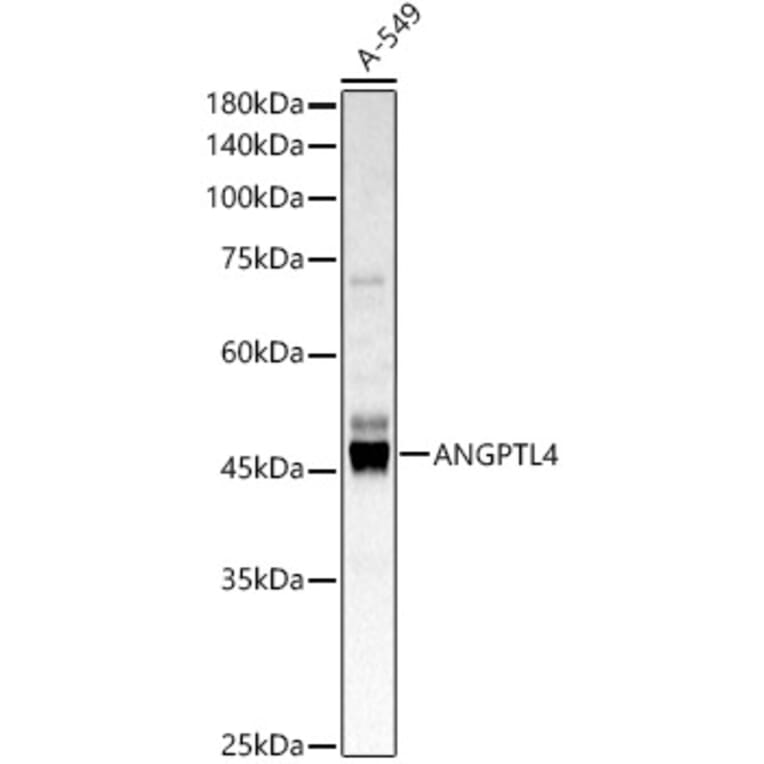 Western Blot - Anti-Angiopoietin-like 4/ANGPTL4 Antibody (A11502) - Antibodies.com