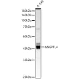 Western Blot - Anti-Angiopoietin-like 4/ANGPTL4 Antibody (A11502) - Antibodies.com