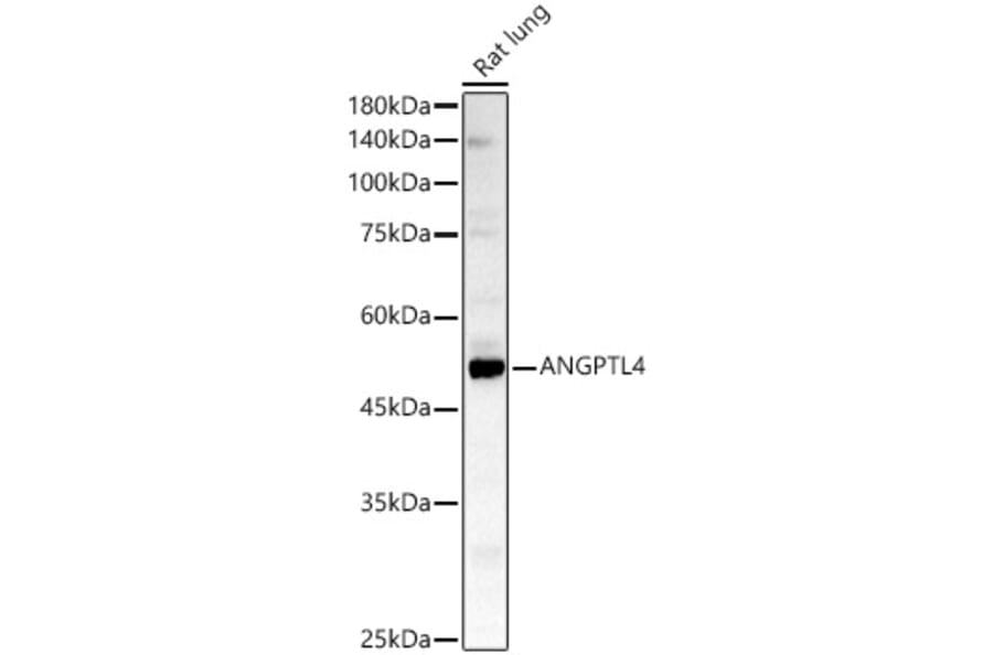 Western Blot - Anti-Angiopoietin-like 4/ANGPTL4 Antibody (A11502) - Antibodies.com