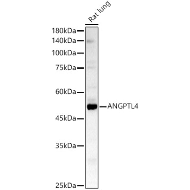 Western Blot - Anti-Angiopoietin-like 4/ANGPTL4 Antibody (A11502) - Antibodies.com