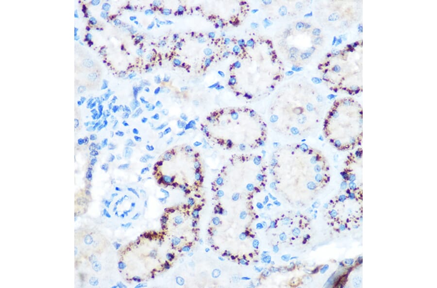 Immunohistochemistry - Anti-Angiopoietin-like 4/ANGPTL4 Antibody (A11502) - Antibodies.com