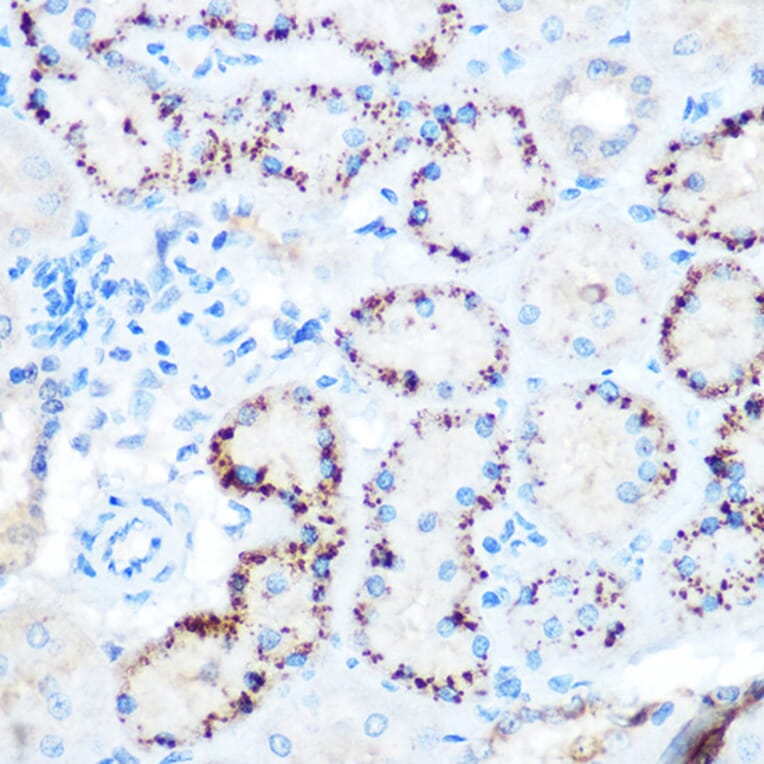 Immunohistochemistry - Anti-Angiopoietin-like 4/ANGPTL4 Antibody (A11502) - Antibodies.com