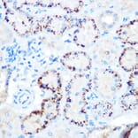 Immunohistochemistry - Anti-Angiopoietin-like 4/ANGPTL4 Antibody (A11502) - Antibodies.com