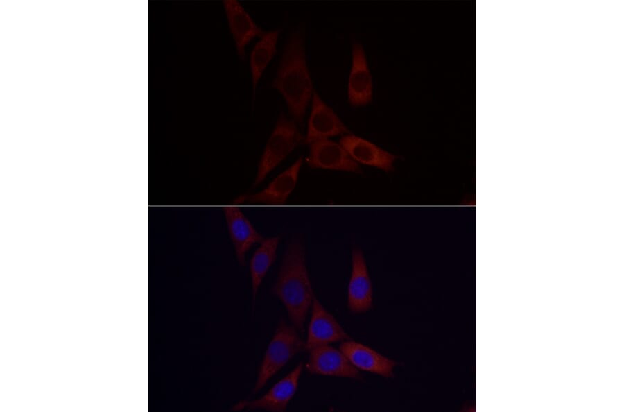 Immunofluorescence - Anti-Angiopoietin-like 4/ANGPTL4 Antibody (A11502) - Antibodies.com