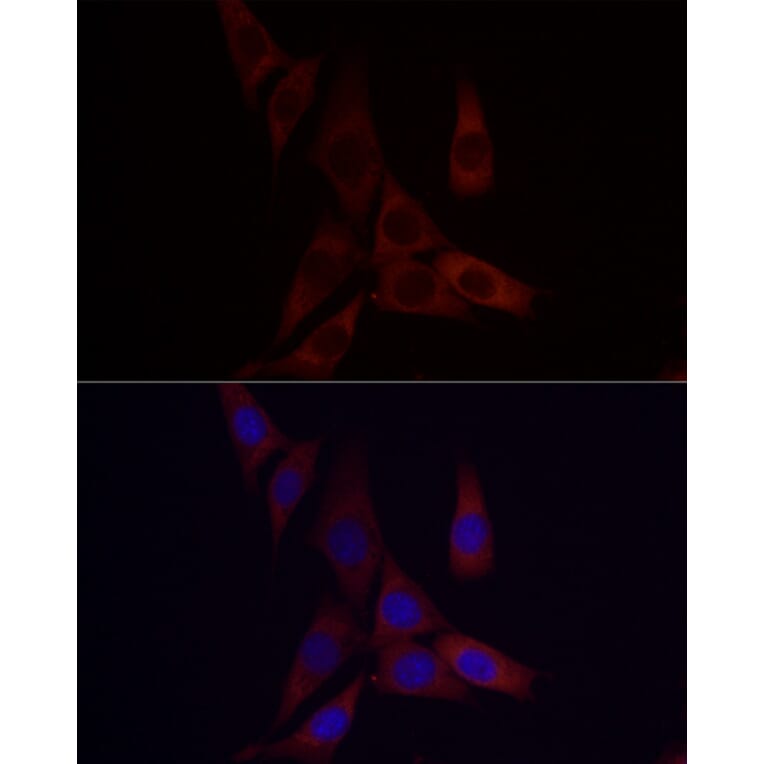 Immunofluorescence - Anti-Angiopoietin-like 4/ANGPTL4 Antibody (A11502) - Antibodies.com