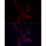 Immunofluorescence - Anti-Angiopoietin-like 4/ANGPTL4 Antibody (A11502) - Antibodies.com