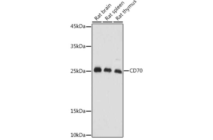 Western Blot - Anti-CD70 Antibody (A11503) - Antibodies.com