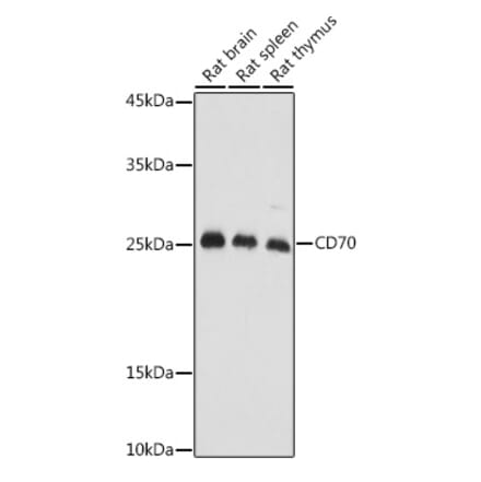 Western Blot - Anti-CD70 Antibody (A11503) - Antibodies.com