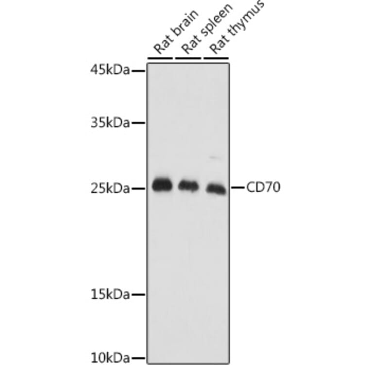 Western Blot - Anti-CD70 Antibody (A11503) - Antibodies.com