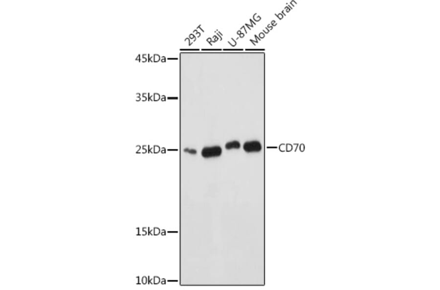 Western Blot - Anti-CD70 Antibody (A11503) - Antibodies.com