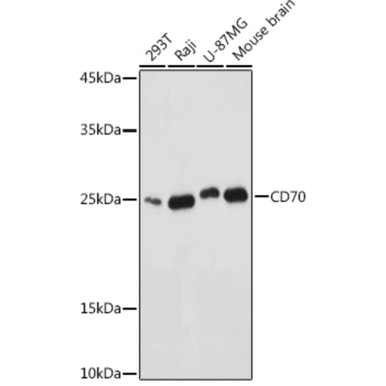 Western Blot - Anti-CD70 Antibody (A11503) - Antibodies.com