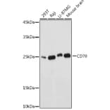 Western Blot - Anti-CD70 Antibody (A11503) - Antibodies.com