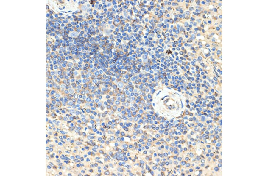 Immunohistochemistry - Anti-CD70 Antibody (A11503) - Antibodies.com