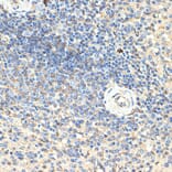 Immunohistochemistry - Anti-CD70 Antibody (A11503) - Antibodies.com