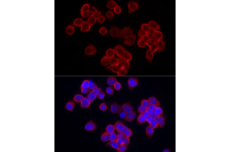 Immunofluorescence - Anti-CD70 Antibody (A11503) - Antibodies.com