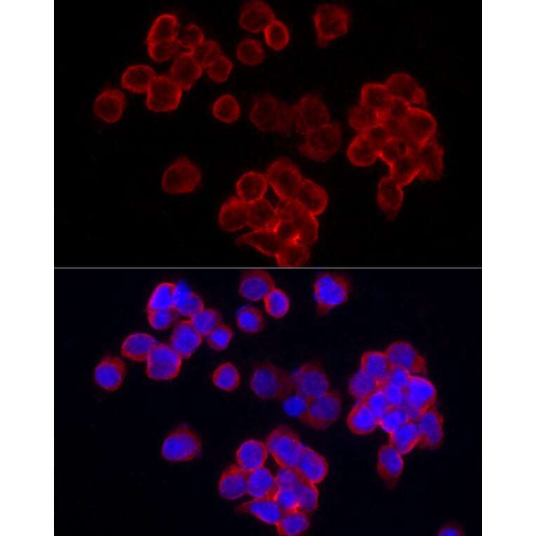 Immunofluorescence - Anti-CD70 Antibody (A11503) - Antibodies.com