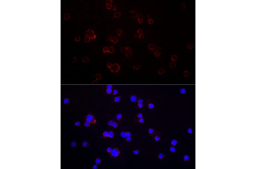 Immunofluorescence - Anti-CD70 Antibody (A11503) - Antibodies.com