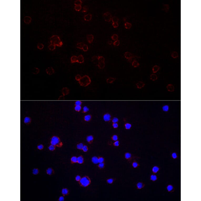 Immunofluorescence - Anti-CD70 Antibody (A11503) - Antibodies.com
