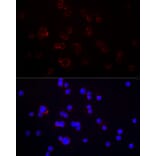 Immunofluorescence - Anti-CD70 Antibody (A11503) - Antibodies.com