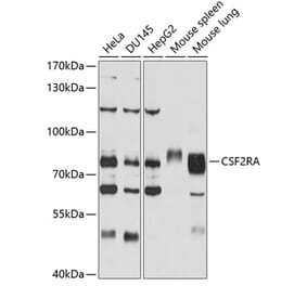 Western Blot - Anti-CD116 Antibody (A11504) - Antibodies.com