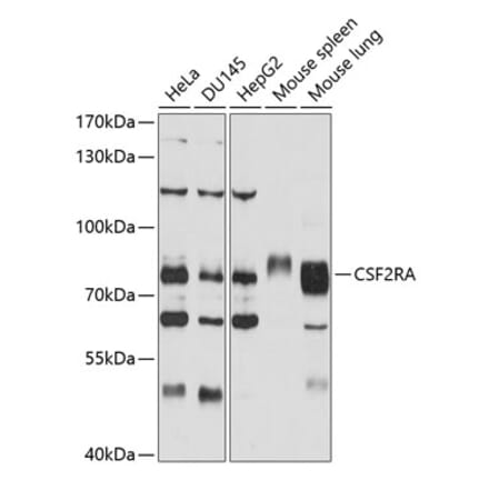 Western Blot - Anti-CD116 Antibody (A11504) - Antibodies.com