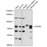 Western Blot - Anti-CD116 Antibody (A11504) - Antibodies.com