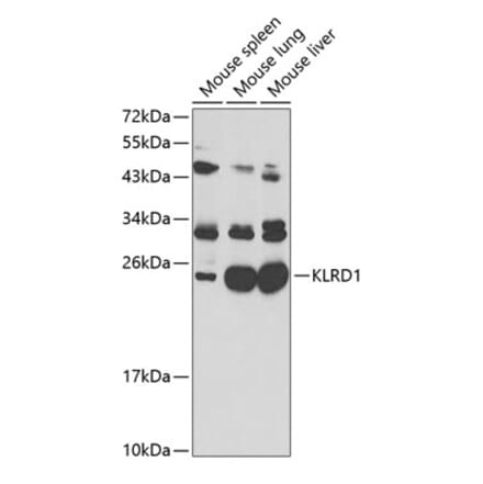 Western Blot - Anti-CD94 Antibody (A11505) - Antibodies.com