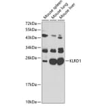 Western Blot - Anti-CD94 Antibody (A11505) - Antibodies.com