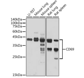 Western Blot - Anti-CD69 Antibody (A11506) - Antibodies.com