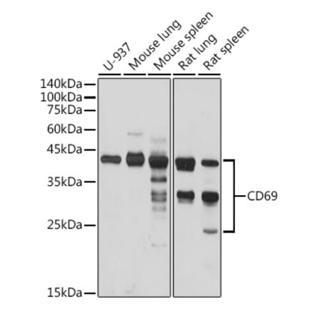 Western Blot - Anti-CD69 Antibody (A11506) - Antibodies.com