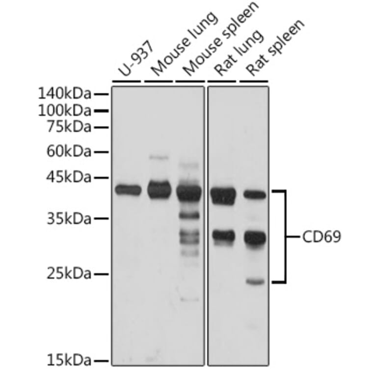 Western Blot - Anti-CD69 Antibody (A11506) - Antibodies.com