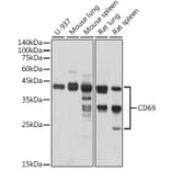 Western Blot - Anti-CD69 Antibody (A11506) - Antibodies.com