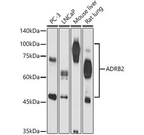 Western Blot - Anti-beta 2 Adrenergic Receptor Antibody (A11507) - Antibodies.com
