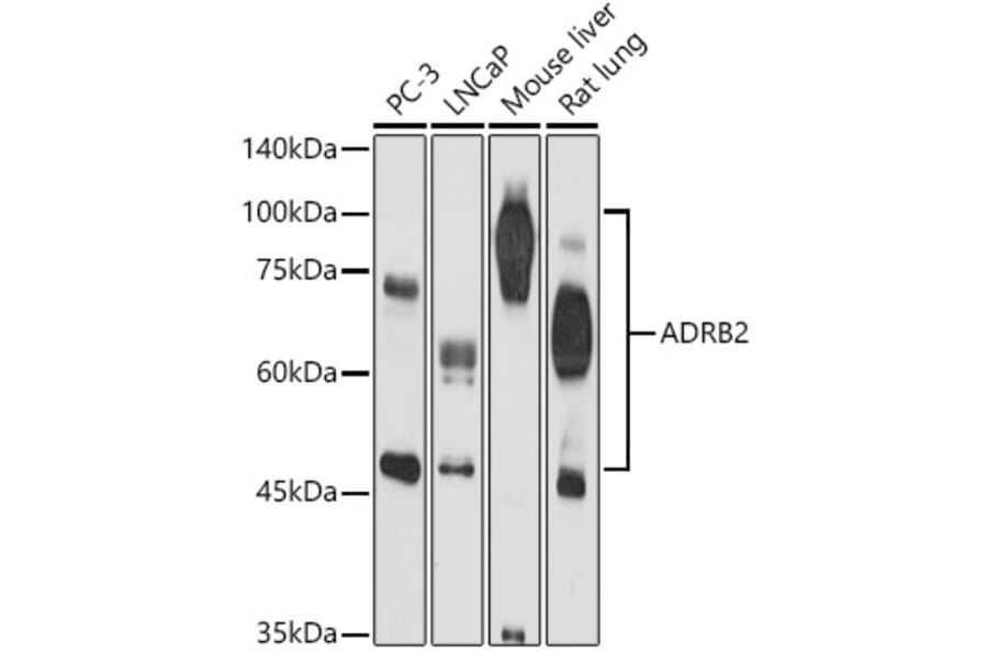 Western Blot - Anti-beta 2 Adrenergic Receptor Antibody (A11507) - Antibodies.com