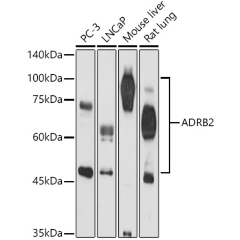 Western Blot - Anti-beta 2 Adrenergic Receptor Antibody (A11507) - Antibodies.com