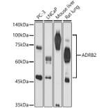 Western Blot - Anti-beta 2 Adrenergic Receptor Antibody (A11507) - Antibodies.com